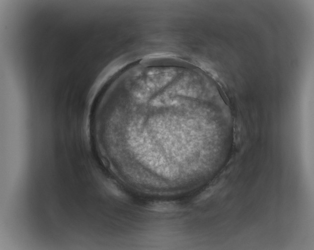 X0000111860296200908201303