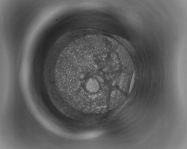 X0000111860765200908201257