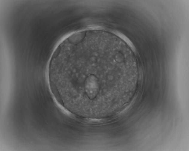 X0000111861439200908201248