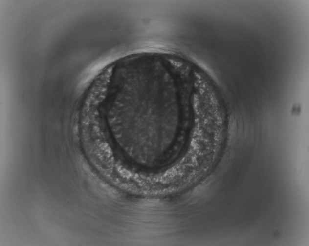 X0000111861455200909031739