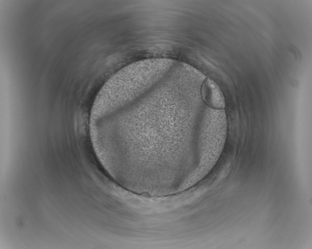 X0000111870038200908131621