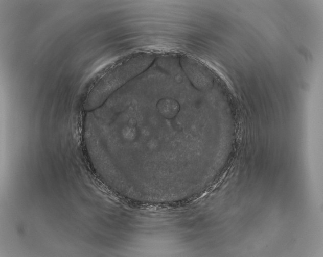 X0000111871015200908131607