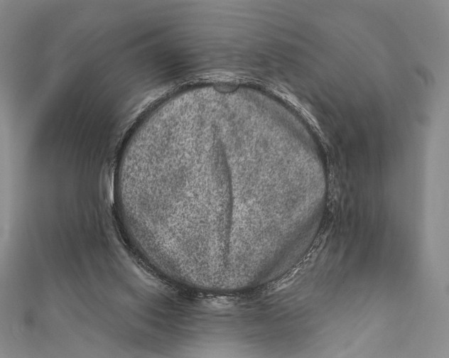 X0000111870062200908201225