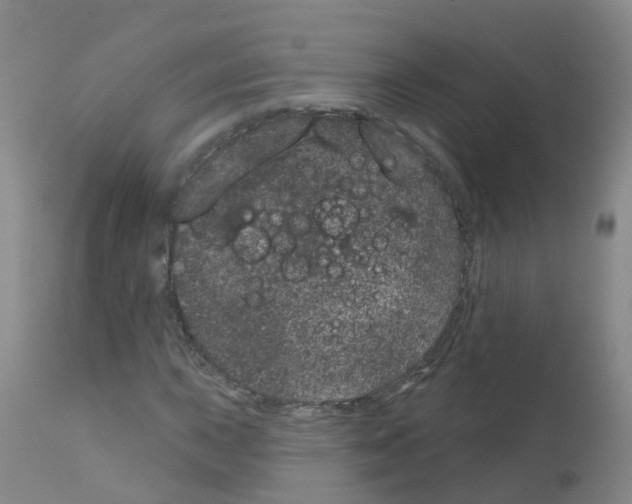 X0000111871015200909031810