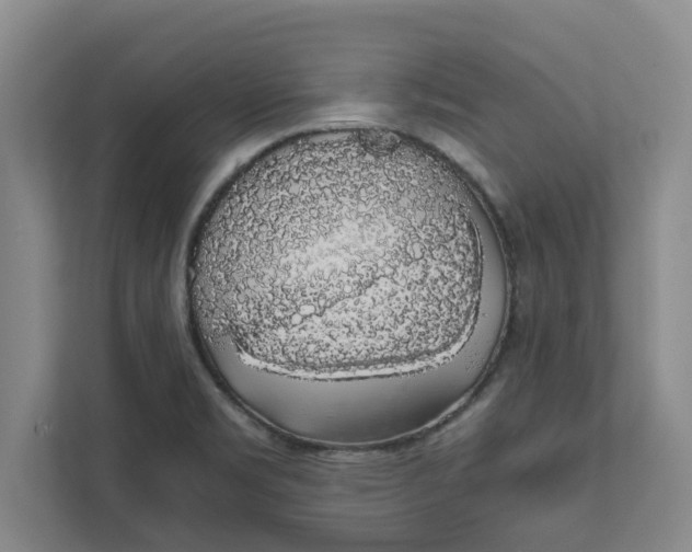 X0000111881469200908061304