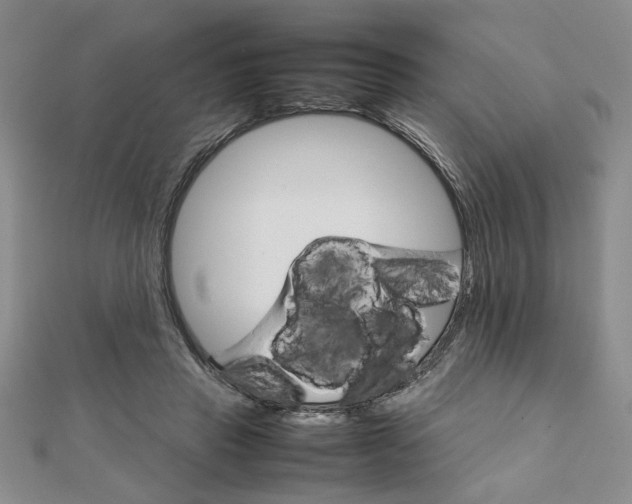 X0000111900453200908031120