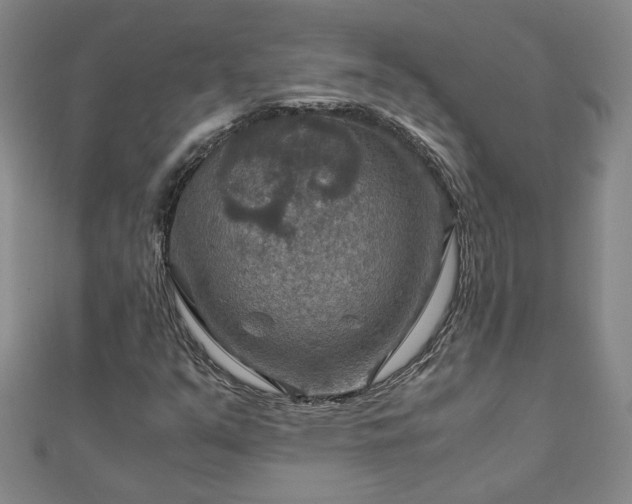 X0000111901351200908031108