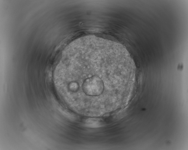 X0000111900179200908241011