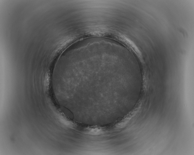 X0000111910113200908031146