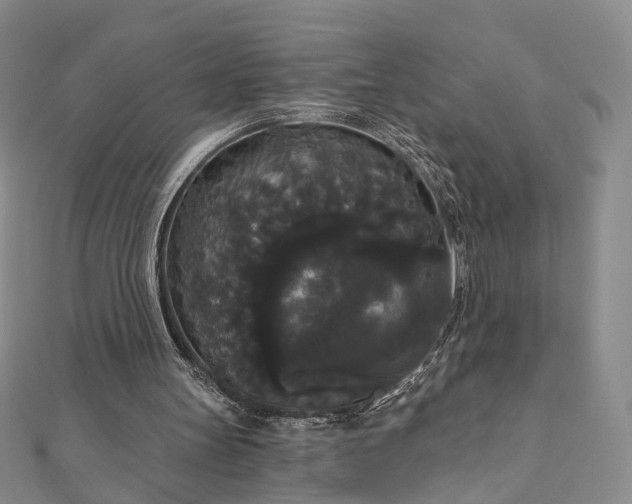 X0000111910147200908031145