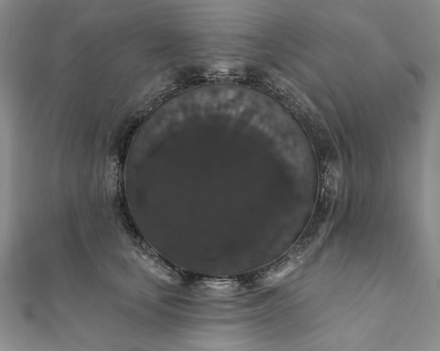 X0000111910659200908031138
