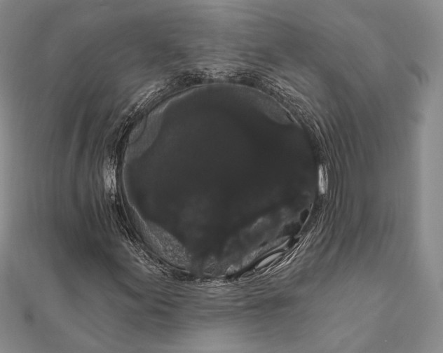 X0000111911155200908101155