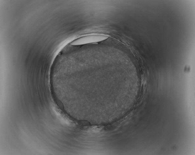 X0000111910148200908241035