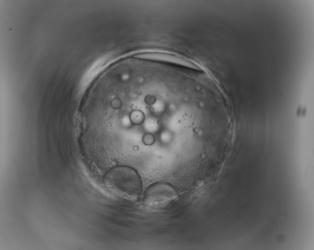 X0000111920151200907271257