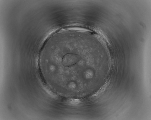 X0000111920159200908031212