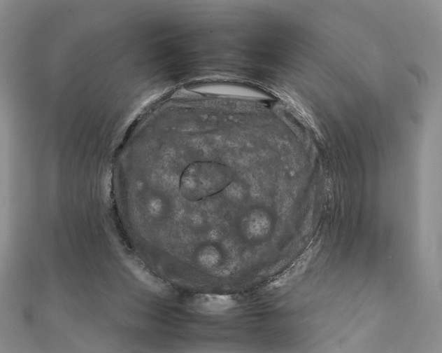 X0000111920159200908101228