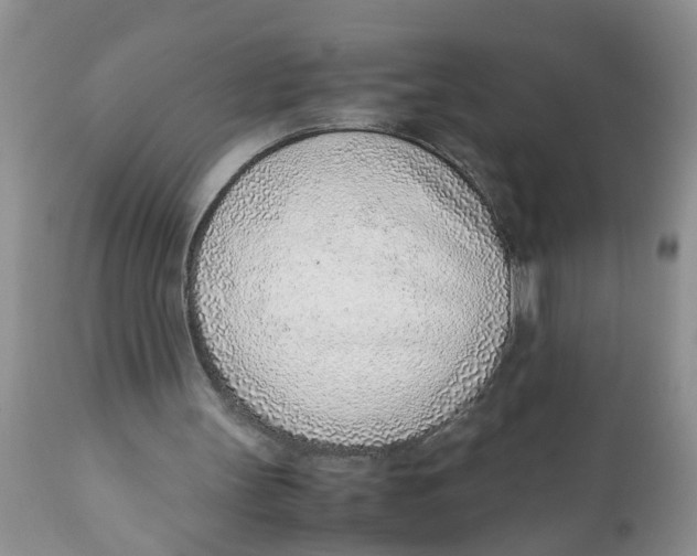 X0000111920147200908171332