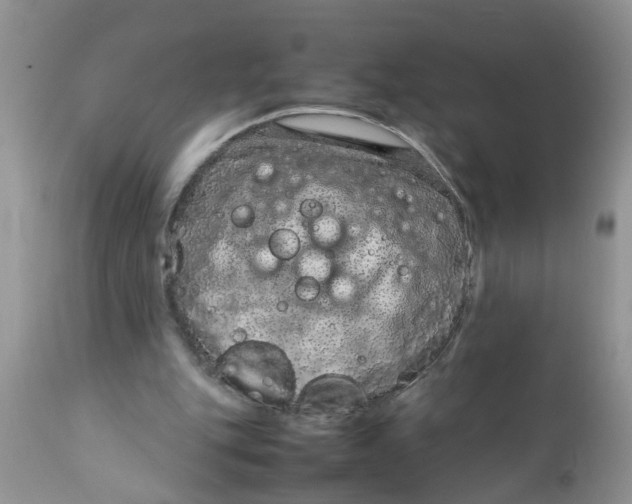 X0000111920151200908171332