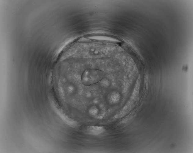 X0000111920159200908171332