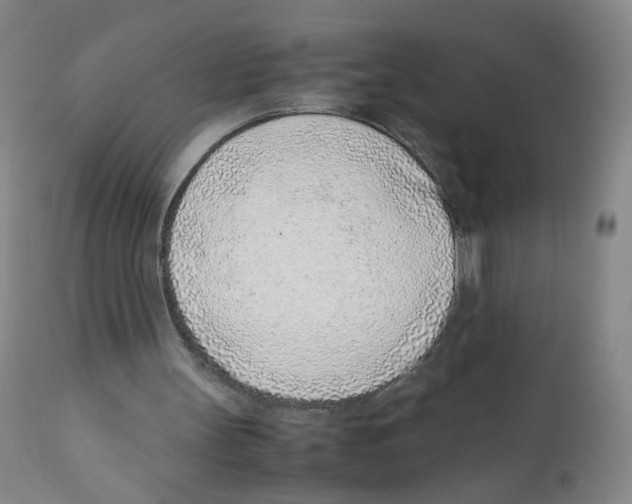 X0000111920147200908241059