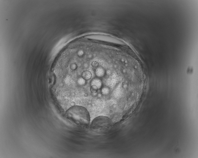 X0000111920151200908241059