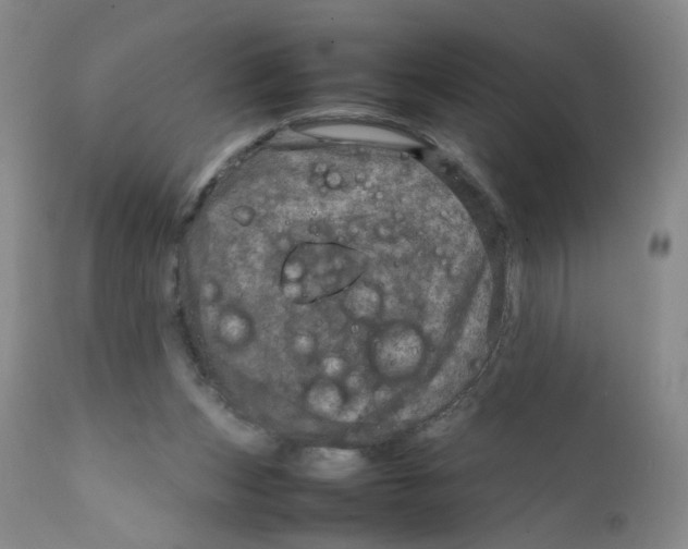 X0000111920159200908241059