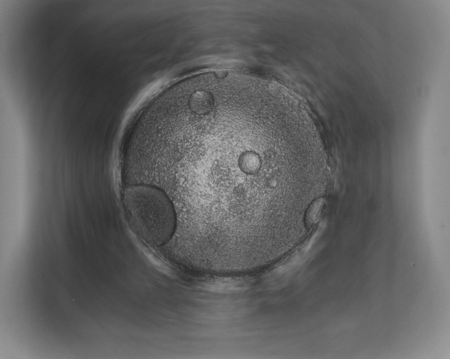 X0000111930149200908031125