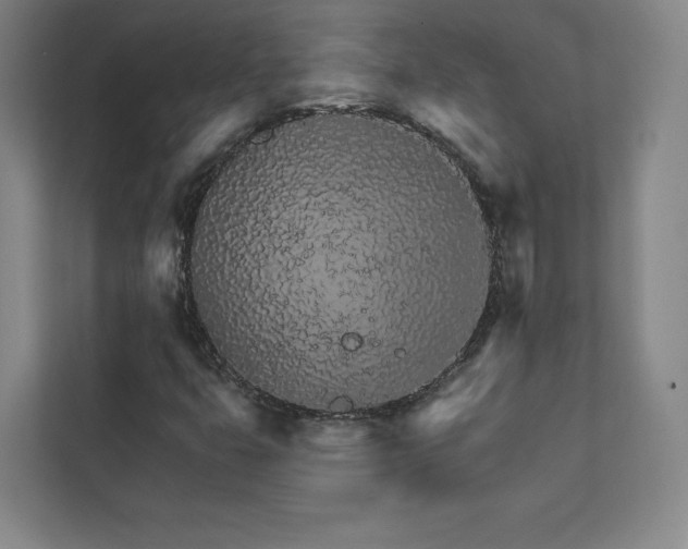 X0000111931399200908031109