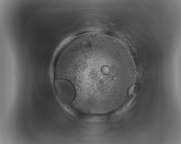 X0000111930149200908101149