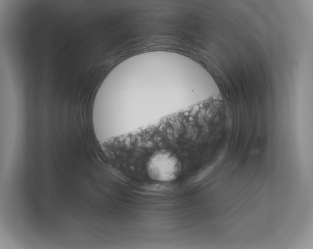 X0000111930575200908171239