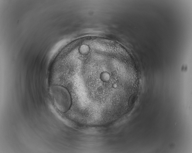 X0000111930149200908241124