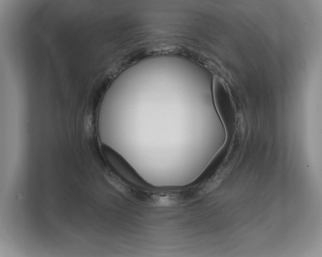 X0000111940564200907271016