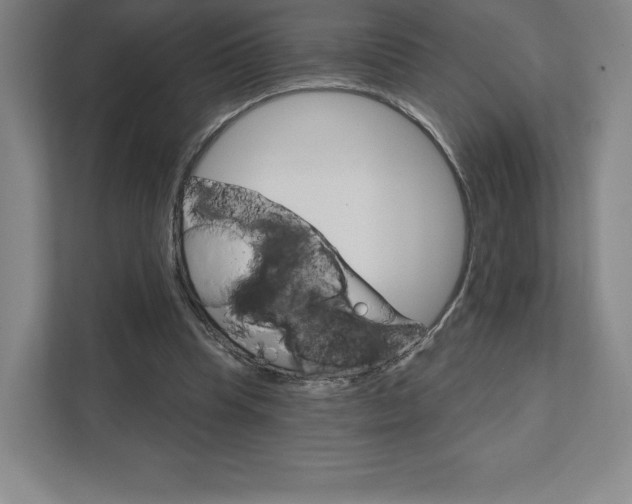 X0000111940345200908031142