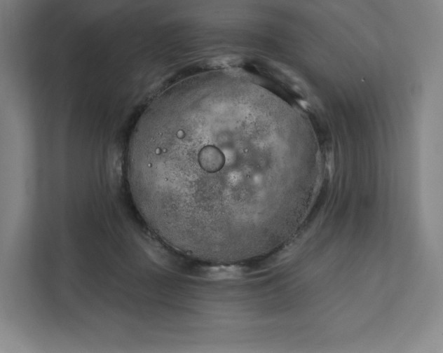 X0000111940363200908031143