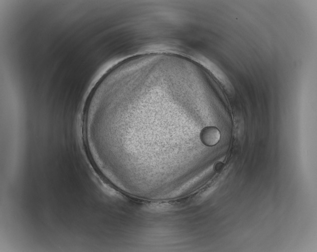 X0000111941094200908101157