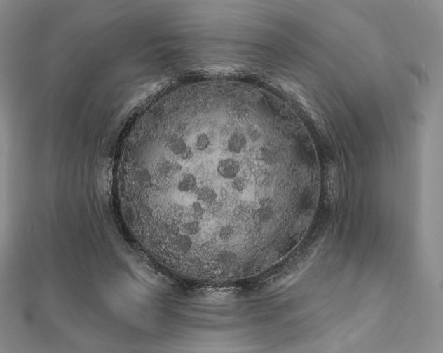 X0000112000495200908031232