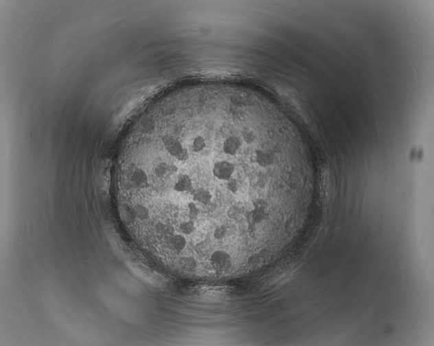 X0000112000495200908171423