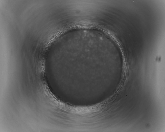 X0000112000017200909141113