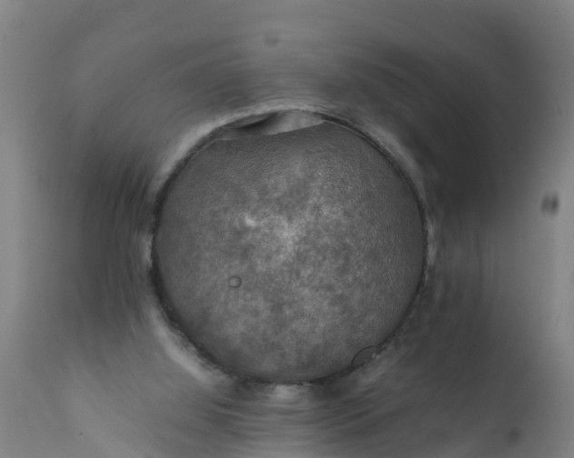 X0000112010060200908171453