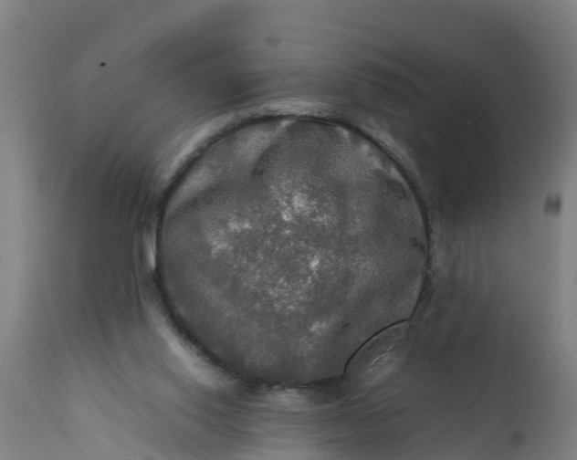 X0000112010062200908171453