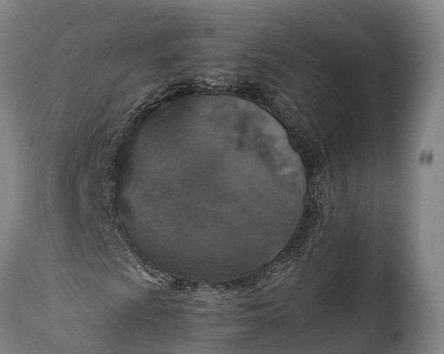 X0000112011009200908171437