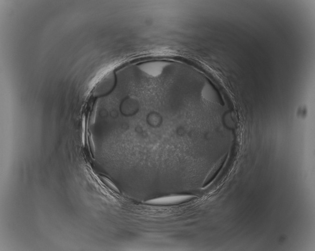 X0000112011171200908171436