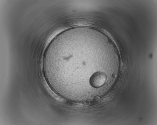 X0000112011195200908171435