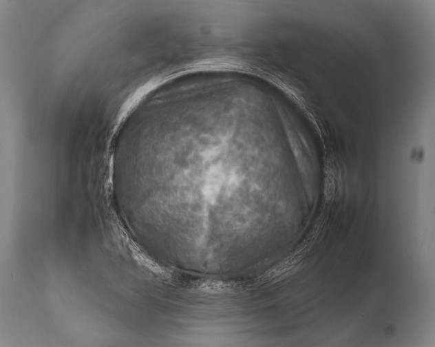 X0000112011366200908171433