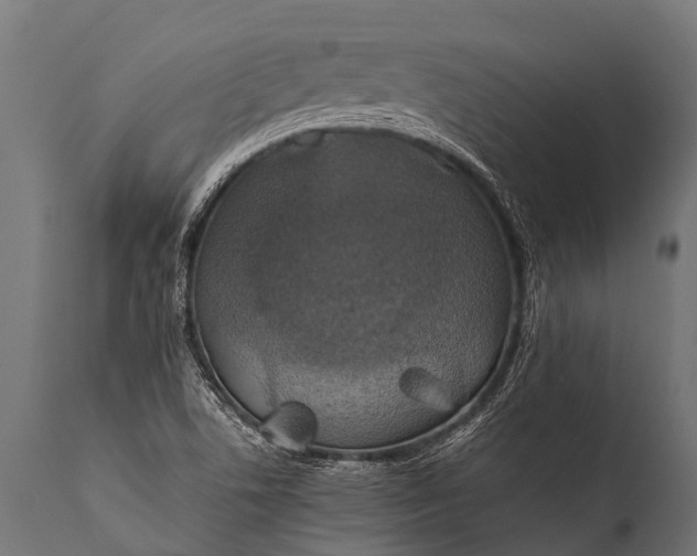 X0000112011506200908171430