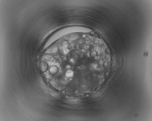 X0000112010351200909141131