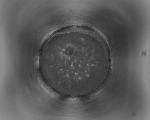 X0000112020067200908031407