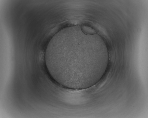 X0000112020036200908171439