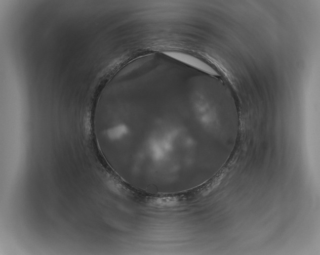 X0000112020353200908171435