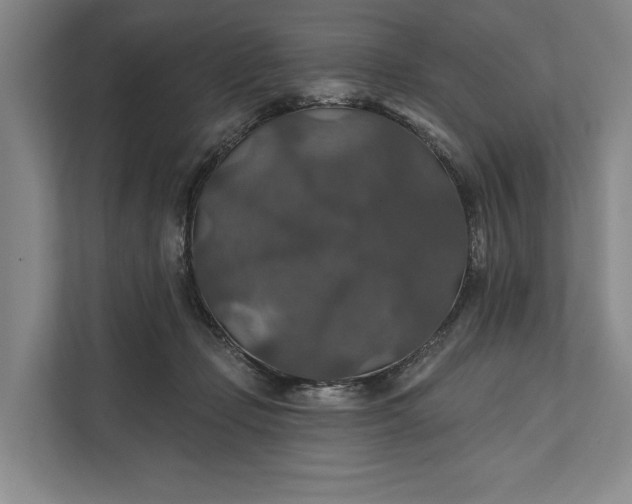 X0000112020365200908171435